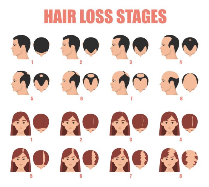 Cause Hair Loss